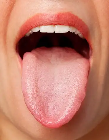 Hygiene of the tongue