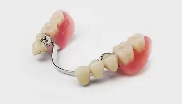 Partial denture