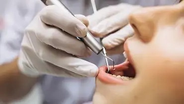 Dental scaling