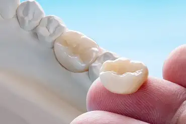 Exemplu de coroana dentara tinuta in mana