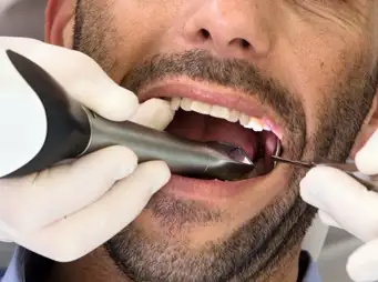 Barbat cu scanner 3D dentar