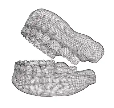 Digital dentures